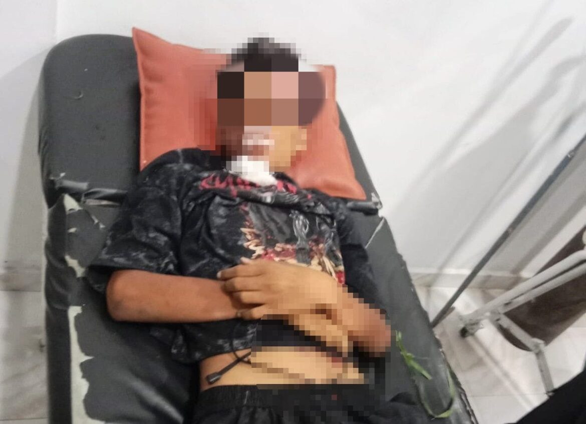 Tabrakan Maut di Batu Bara, Pemotor Tabrak L300 Pickup Akhirnya Meninggal Dunia